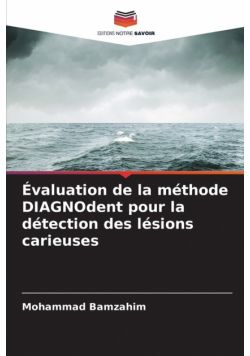 Évaluation de la méthode DIAGNOdent pour la détection des lésions carieuses