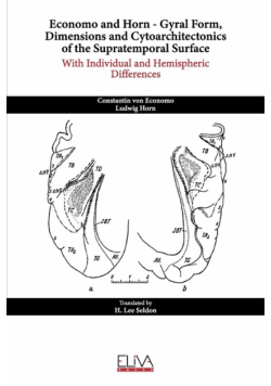 Economo and Horn - Gyral Form, Dimensions and Cytoarchitectonics of the Supratemporal Surface