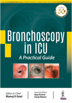 Bronchoscopy in ICU