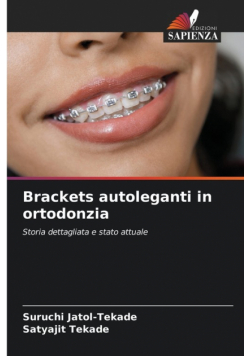 Brackets autoleganti in ortodonzia