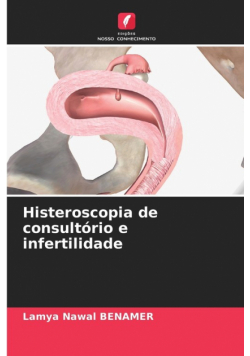Histeroscopia de consultório e infertilidade