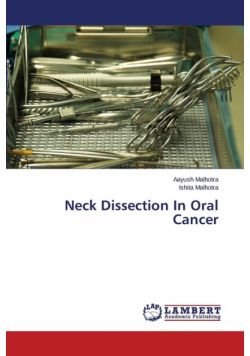 Neck Dissection in Oral Cancer