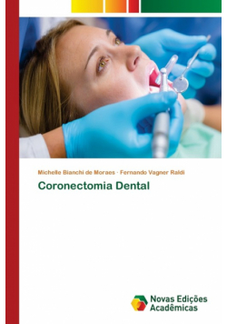 Coronectomia Dental