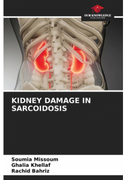 Kidney Damage In Sarcoidosis
