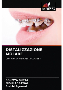 Distalizzazione Molare