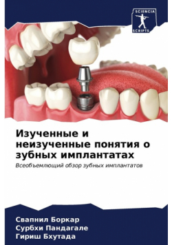 Изученные и неизученные понятия о зубных имплантатах