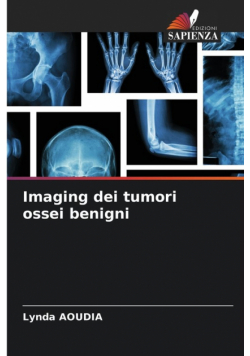 Imaging dei tumori ossei benigni