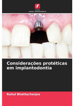 Considerações protéticas em implantodontia