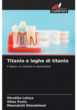 Titanio e leghe di titanio
