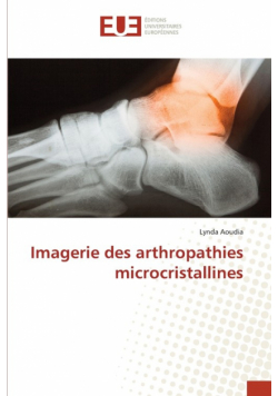 Imagerie des arthropathies microcristallines