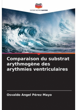 Comparaison du substrat arythmogène des arythmies ventriculaires