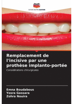 Remplacement de l'incisive par une prothèse implanto-portée