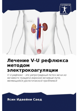 Лечение V-U Рефлюкса Методом Электрокоагуляции