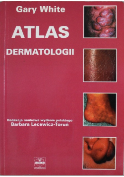 Atlas dermatolgii