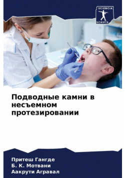 Подводные камни в несъемном протезировании