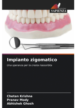 Impianto zigomatico