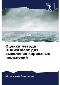 Оценка метода DIAGNOdent для выявления кариозных поражений