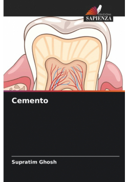 Cemento