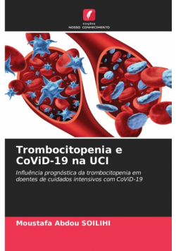 Trombocitopenia e CoViD-19 na UCI