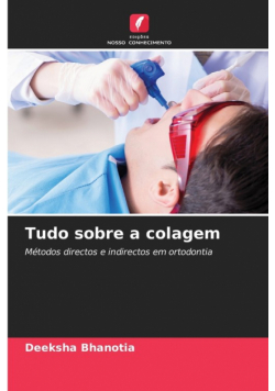 Tudo sobre a colagem