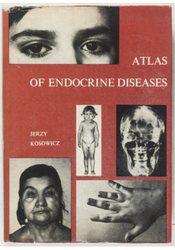 Atlas of endocrine diseases 1978