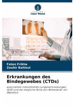 Erkrankungen des Bindegewebes (CTDs)