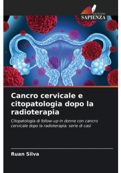 Cancro cervicale e citopatologia dopo la radioterapia