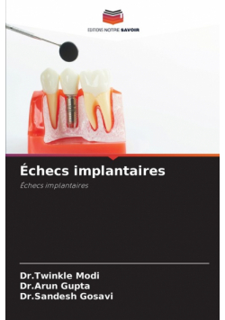 Échecs implantaires
