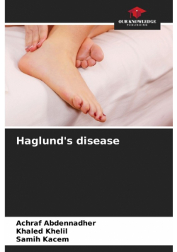 Haglund's disease