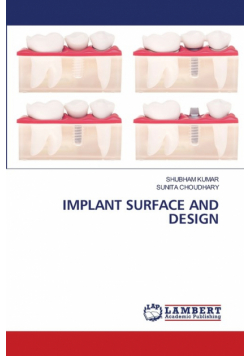 Implant Surface And Design