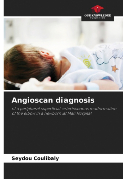 Angioscan diagnosis