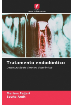 Tratamento endodôntico