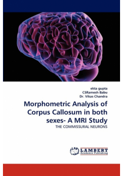 Morphometric Analysis of Corpus Callosum in both sexes- A MRI Study