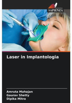 Laser in Implantologia
