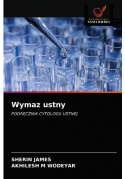 Wymaz ustny
