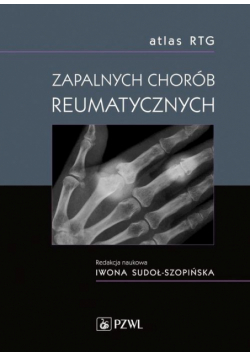 Atlas RTG zapalnych chorób reumatycznych