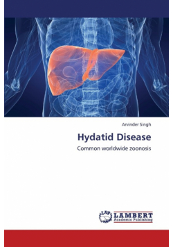 Hydatid Disease