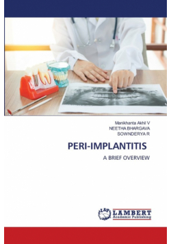 Peri-Implantitis