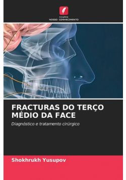 Fracturas Do Terço Médio Da Face