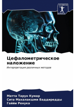 Цефалометрическое наложение