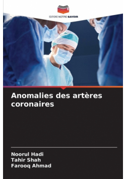 Anomalies des artères coronaires