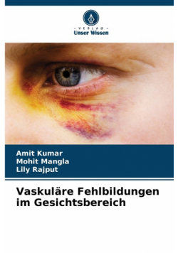 Vaskuläre Fehlbildungen im Gesichtsbereich