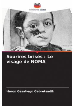 Sourires brisés