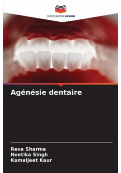 Agénésie dentaire