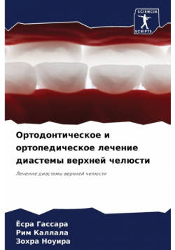 Ортодонтическое и ортопедическое лечение диастемы верхней челюсти