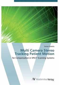 Multi Camera Stereo Tracking Patient Motion