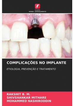 Complicações No Implante
