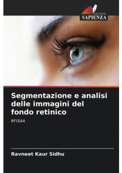 Segmentazione e analisi delle immagini del fondo retinico