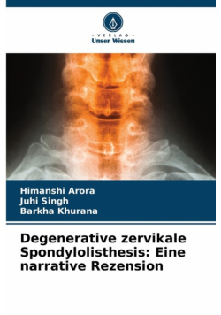 Degenerative zervikale Spondylolisthesis