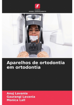 Aparelhos de ortodontia em ortodontia
